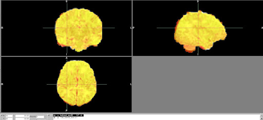 FuncStruct_registration_HeatMap
